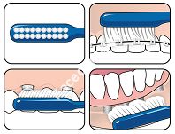Szczoteczka TePe Implant Orthodontic - 4
